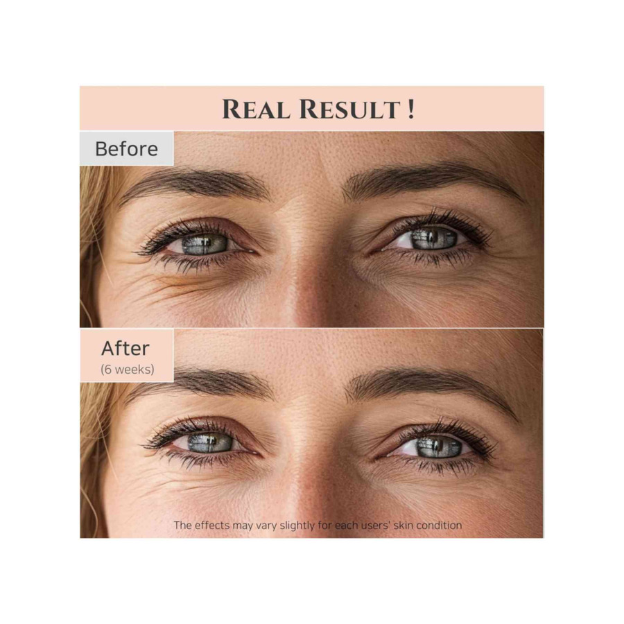 Revive Eye Serum : Ginseng + Retinal - Image 4