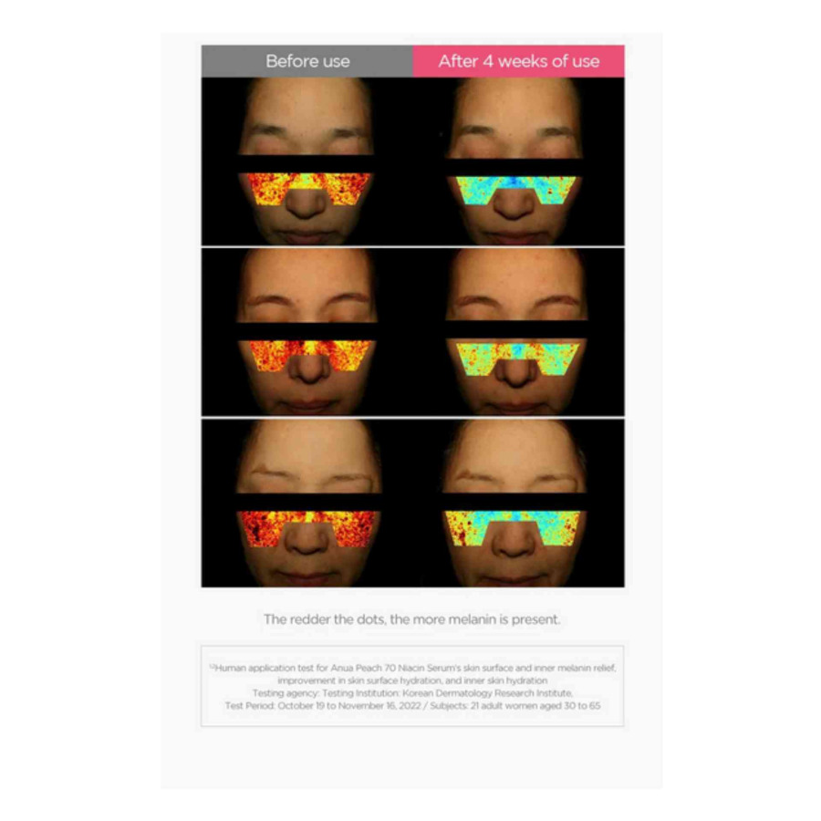 Peach 70% Niacin Serum - Image 5