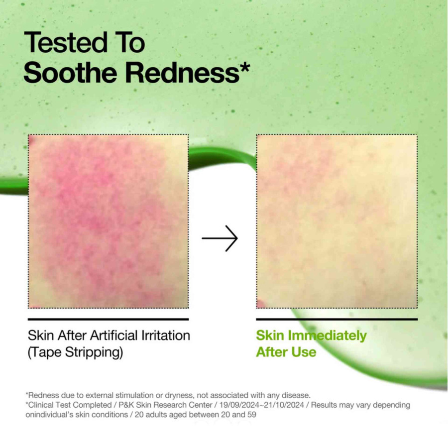 Azelaic Acid 10 Hyaluron Redness Soothing Serum - Image 3
