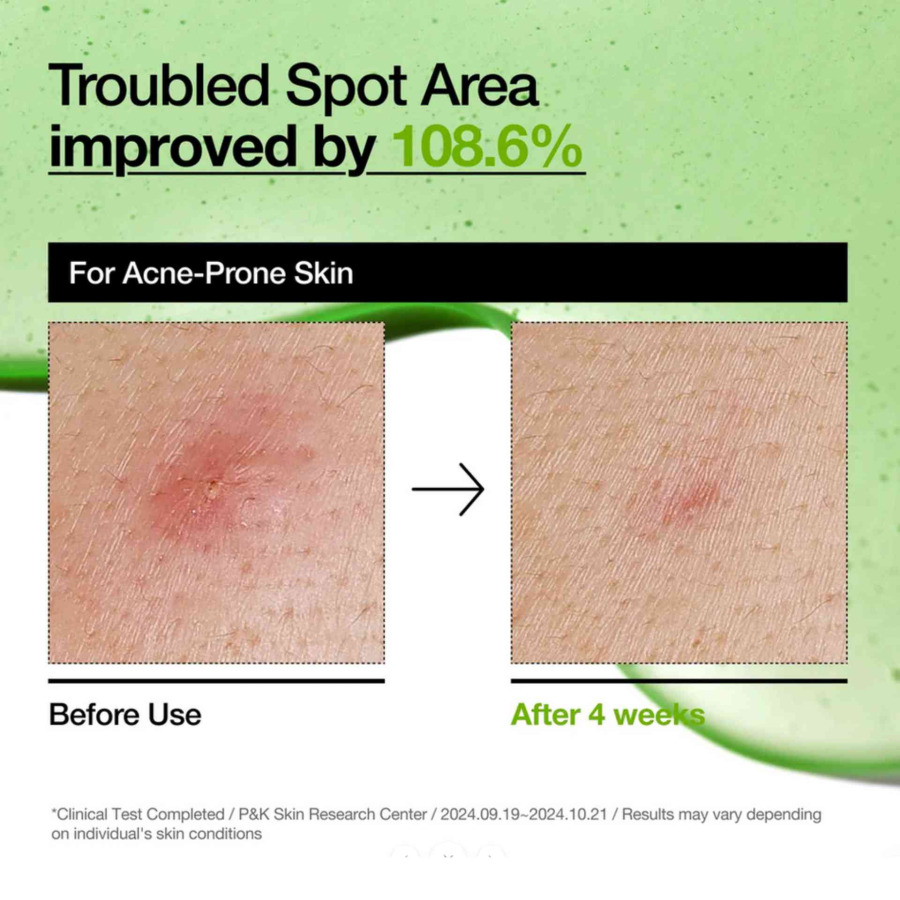 Azelaic Acid 10 Hyaluron Redness Soothing Serum - Image 4