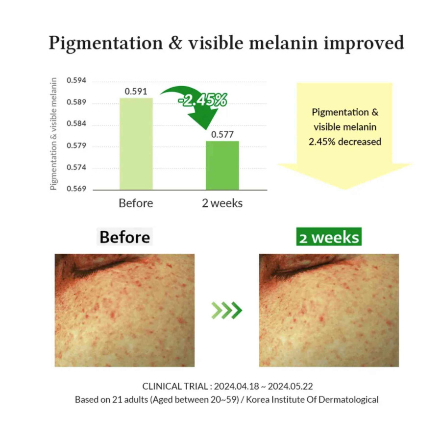Gentle Vitamin C Serum - Image 3