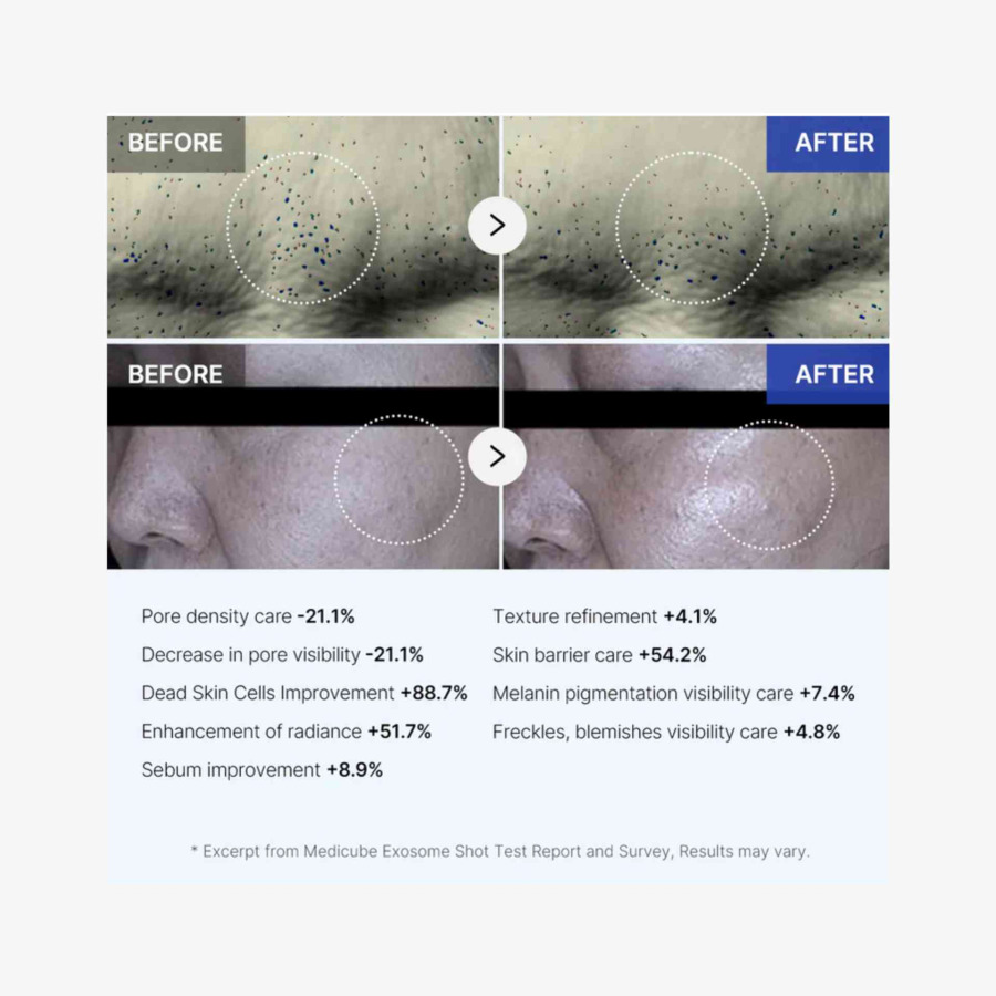 One Day Exosome shot Pore Ampoule 7500 - Image 9