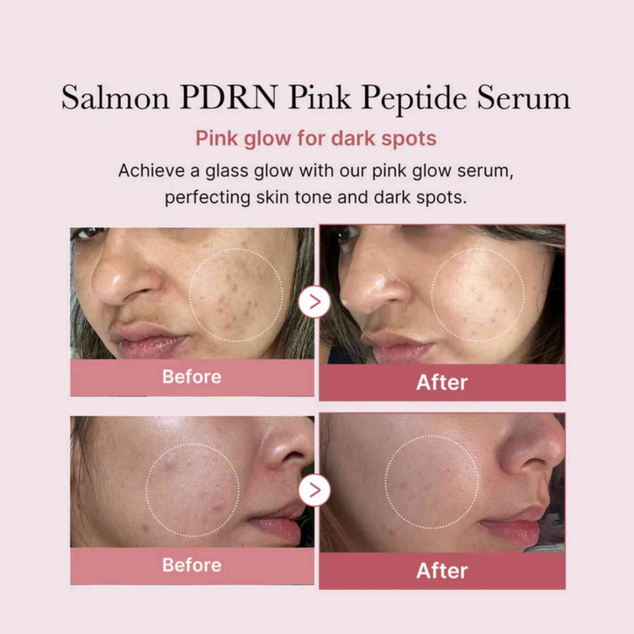 PDRN Pink Peptide Glow Serum - Image 3
